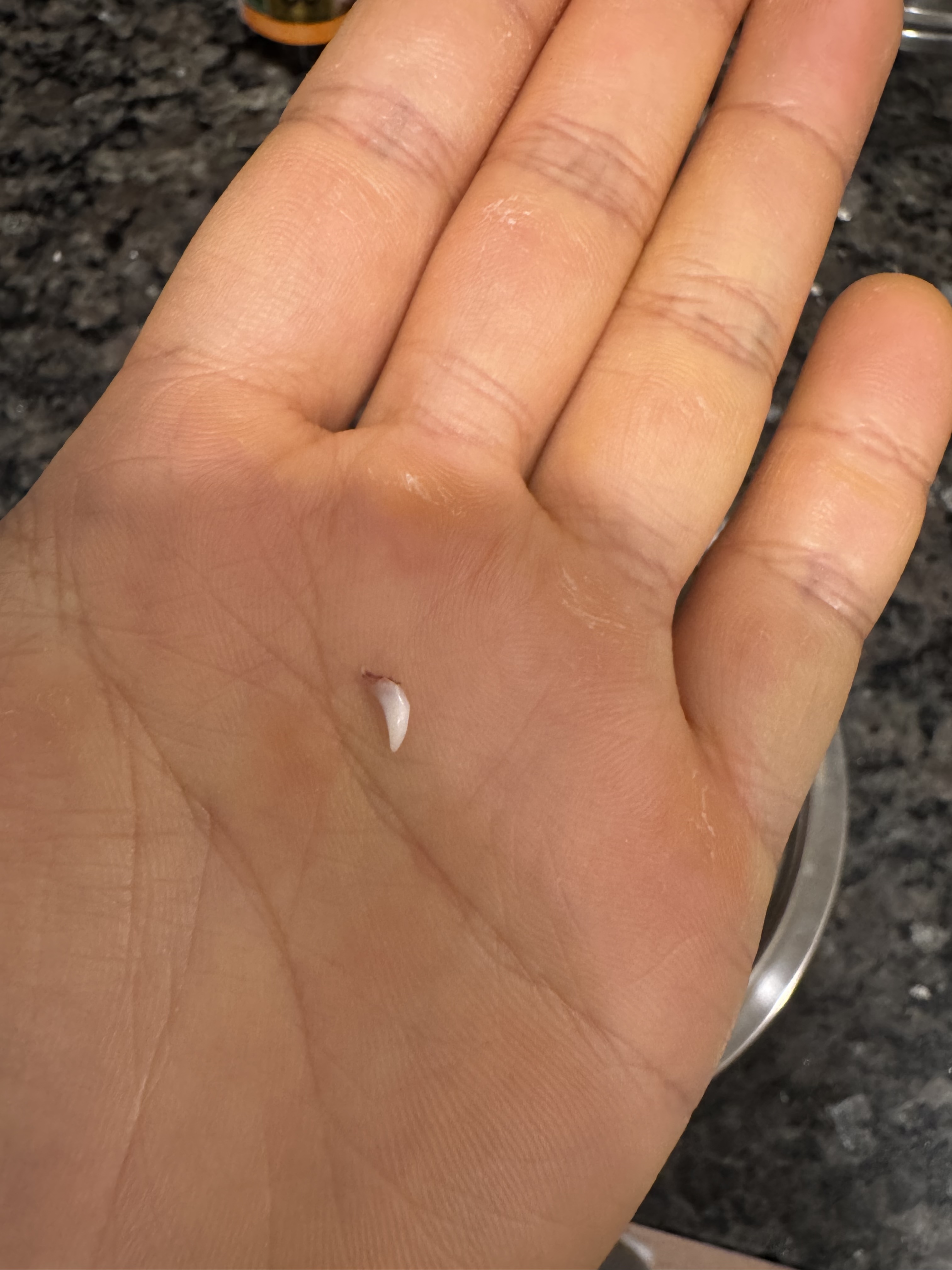 Friday's baby canine tooth